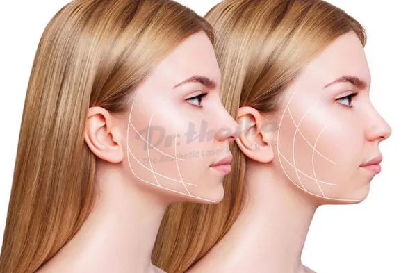 Các dáng cằm tiêm filler đẹp được nhiều bạn nữ yêu thích