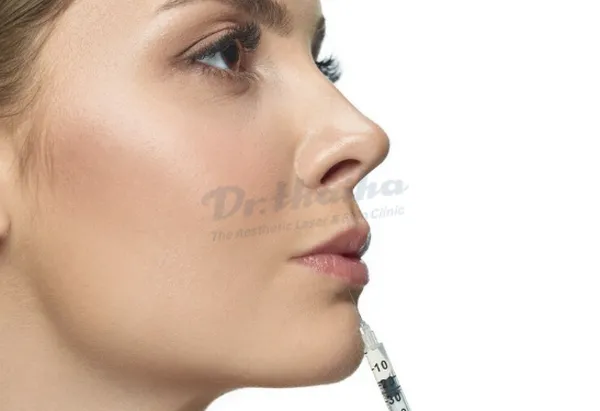 Dáng môi tiêm filler đẹp được chị em phụ nữ lăng xê nhiều nhất