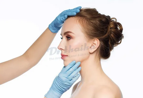 Hậu quả của tiêm filler cằm ở địa chỉ không đủ uy tín