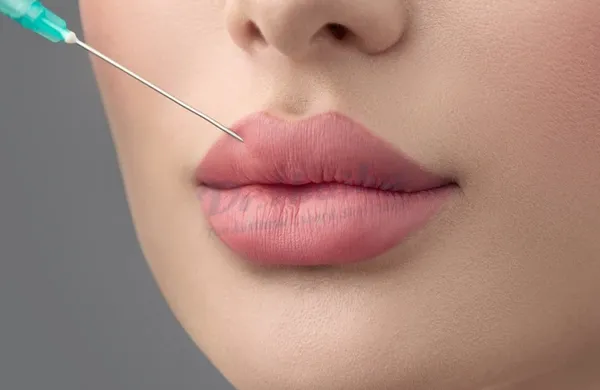 Hậu quả tiêm filler môi ở địa chỉ thiếu uy tín