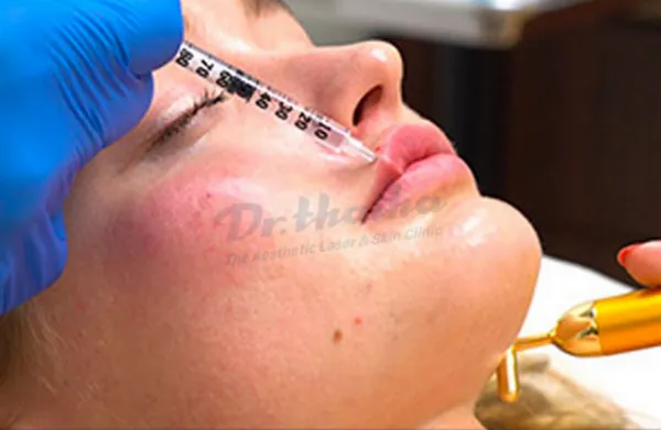 Tiêm filler ăn ếch được không? Có ảnh hưởng gì không