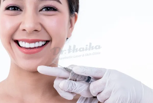 Tiêm filler cằm ở đâu an toàn và đẹp