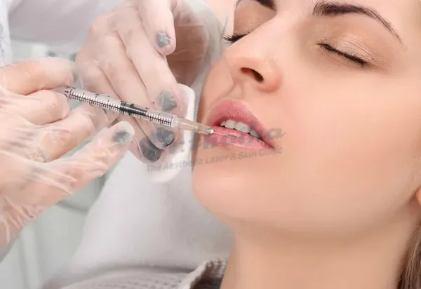 Tiêm filler xong bị sốt nên xử lý như thế nào?