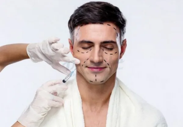 Cách xác định vị trí, điểm tiêm botox hàm