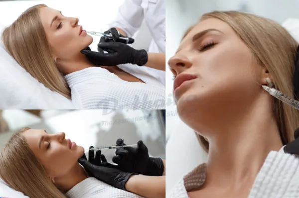 Địa chỉ tiêm botox uy tín tại Hà Nội bạn nên biết