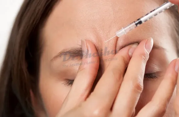 Kỹ thuật tiêm botox khách hàng cần nên biết