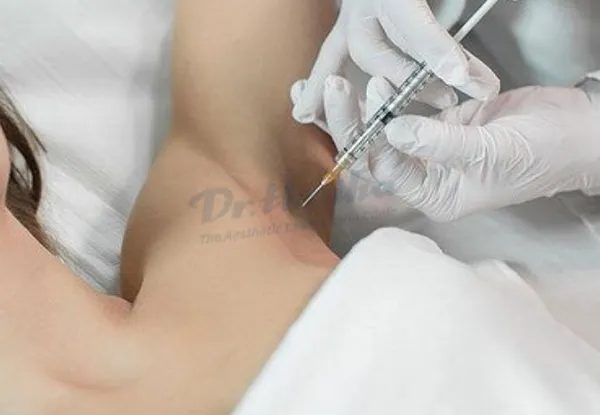 Liều lượng tiêm botox? Thông tin cần biết trước khi tiêm