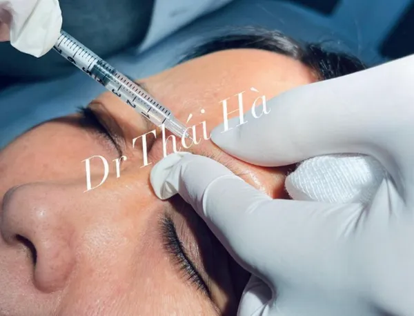 Review tiêm botox tại phòng khám da liễu thẩm mỹ Dr.thaiha