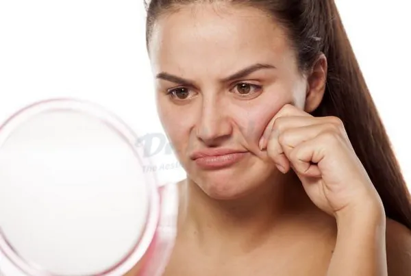 Sau khi tiêm botox thon gọn hàm nên kiêng gì?