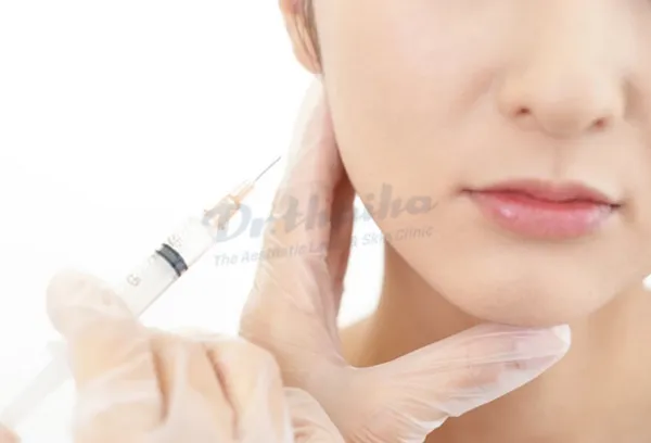 Tiêm botox gọn hàm bao lâu có tác dụng, bao lâu hiệu quả?