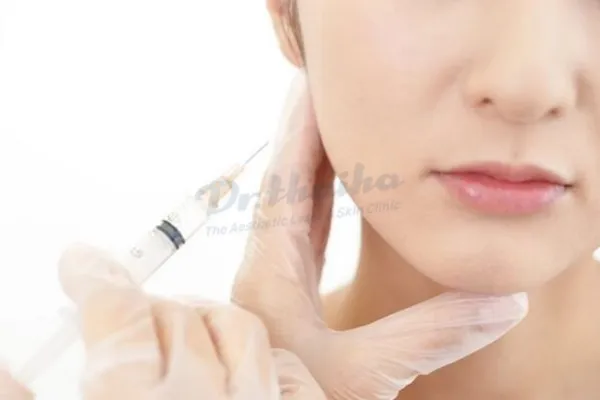 Tiêm botox hàm bao lâu có tác dụng? Giữ được bao lâu thì tiêm lại?