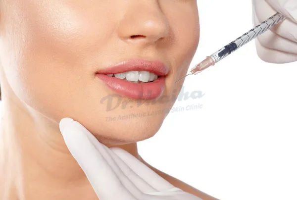 Tiêm botox hàm bao nhiêu tiền? Giá tiêm 2024