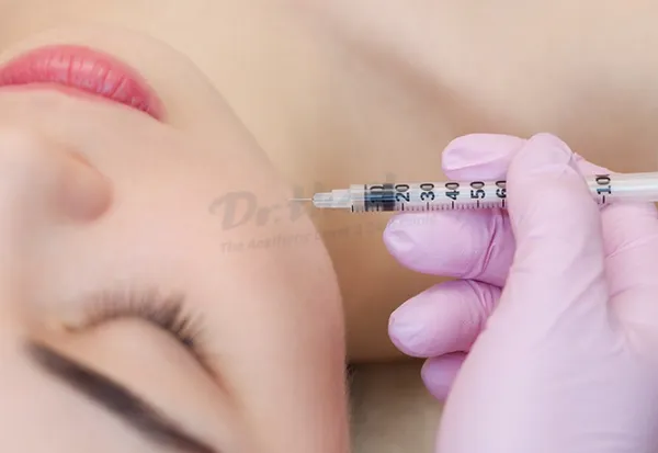 Tiêm filler vào mặt có ảnh hưởng gì không?