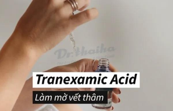 Tiêm meso tranexamic acid là gì? Có tác dụng gì?