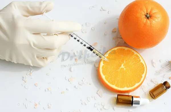 Tiêm meso vitamin C là gì? Có tốt không?