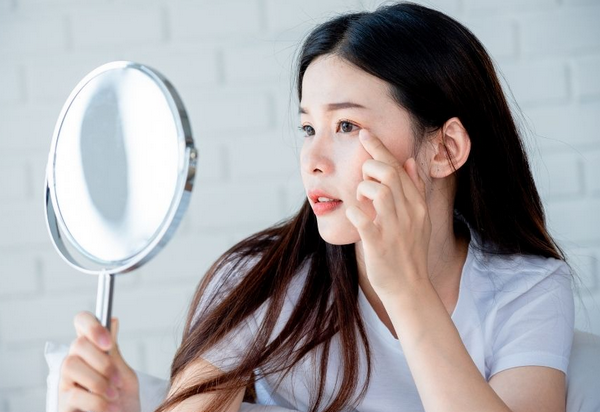 Mụn ẩn có peel da được không? Chuyên gia chia sẻ